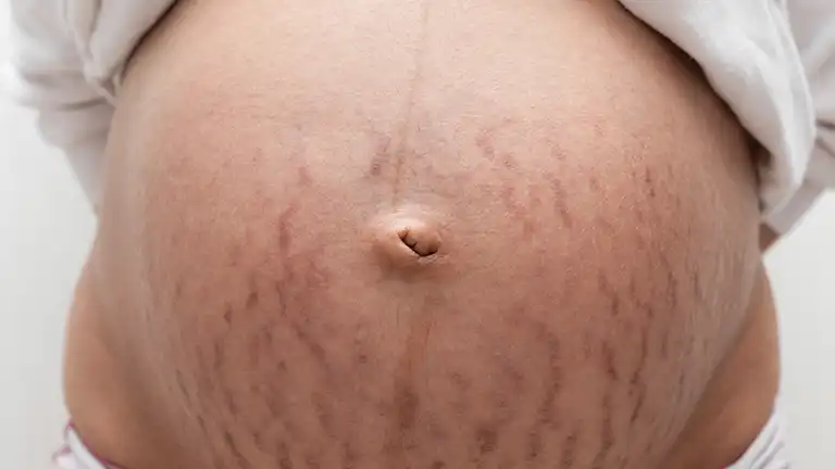 妊娠中から産後までモナマミーの妊娠線ケアクリームは子どもも使えてコスパ優秀2