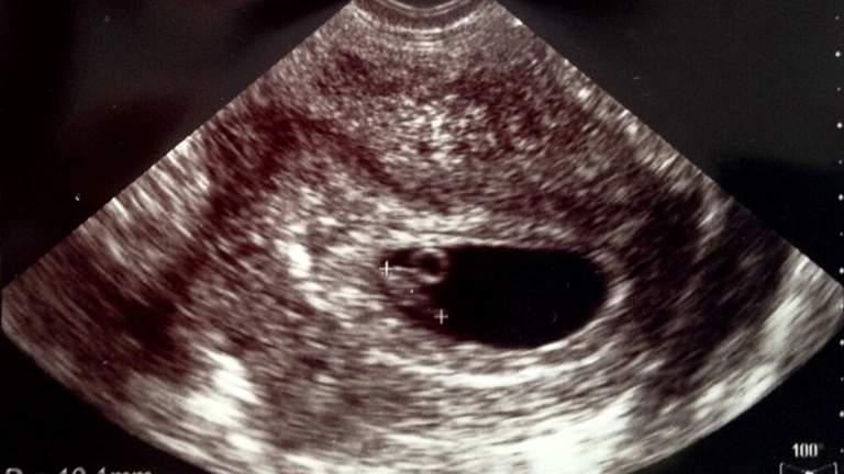 妊娠4週目の胎児の発育