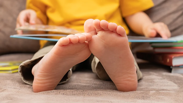 子どもの足のトラブル「内反小趾（ナイハンショウシ）」についてのお話・その対策法！